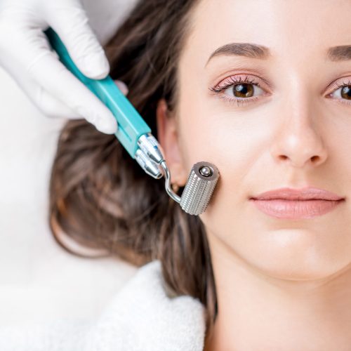 Making dry needlying procedure on woman's face in the cosmetology office