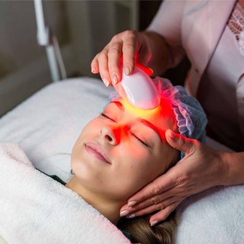 Photo Facial Treatment